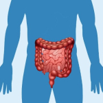 Imagen Un 40% se diagnostica en etapas avanzadas
